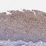 Peptidylarginine Deiminase Antibody in Immunohistochemistry (Paraffin) (IHC (P))