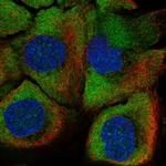 Peptidylarginine Deiminase Polyclonal Antibody