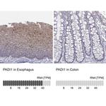 Peptidylarginine Deiminase Antibody in Immunohistochemistry (IHC)