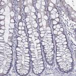 Peptidylarginine Deiminase Antibody in Immunohistochemistry (IHC)