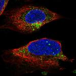 UNC13B Polyclonal Antibody