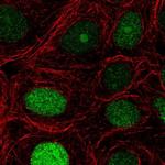 NUCKS1 Polyclonal Antibody