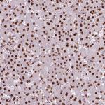 NUCKS1 Antibody in Immunohistochemistry (Paraffin) (IHC (P))