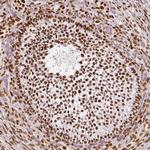 NUCKS1 Antibody in Immunohistochemistry (Paraffin) (IHC (P))