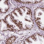 NUCKS1 Antibody in Immunohistochemistry (Paraffin) (IHC (P))