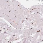 NUCKS1 Antibody in Immunohistochemistry (Paraffin) (IHC (P))