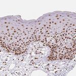 NUCKS1 Antibody in Immunohistochemistry (Paraffin) (IHC (P))
