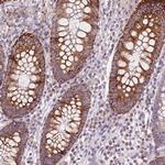 COX6A1 Antibody in Immunohistochemistry (Paraffin) (IHC (P))