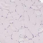 COX6A1 Antibody in Immunohistochemistry (Paraffin) (IHC (P))