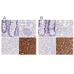 PNLIP Polyclonal Antibody
