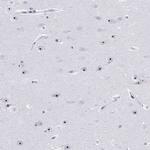 PES1 Polyclonal Antibody