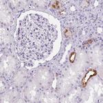 S100A2 Polyclonal Antibody