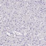 S100A2 Antibody in Immunohistochemistry (Paraffin) (IHC (P))