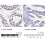 C2orf70 Antibody in Immunohistochemistry (IHC)