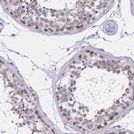 C2orf70 Antibody in Immunohistochemistry (IHC)