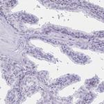 C2orf70 Antibody in Immunohistochemistry (IHC)