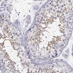 C3orf30 Antibody in Immunohistochemistry (IHC)