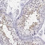 C3orf30 Polyclonal Antibody