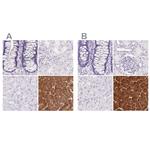 PNLIP Polyclonal Antibody