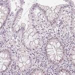 BATF2 Antibody in Immunohistochemistry (Paraffin) (IHC (P))