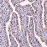 BATF2 Antibody in Immunohistochemistry (Paraffin) (IHC (P))