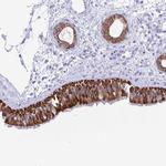 ZNF781 Antibody in Immunohistochemistry (Paraffin) (IHC (P))