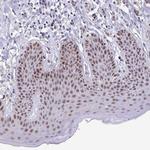 ZNF691 Antibody in Immunohistochemistry (Paraffin) (IHC (P))