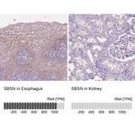 SBSN Antibody in Immunohistochemistry (IHC)