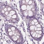SBSN Antibody in Immunohistochemistry (IHC)