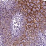 SBSN Antibody in Immunohistochemistry (IHC)