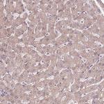 NKG2E Antibody in Immunohistochemistry (Paraffin) (IHC (P))