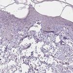 NKG2E Antibody in Immunohistochemistry (Paraffin) (IHC (P))