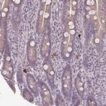 NKG2E Antibody in Immunohistochemistry (Paraffin) (IHC (P))