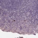 NKG2E Polyclonal Antibody