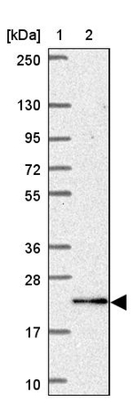 C15orf29 Antibody in Western Blot (WB)