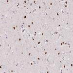 SP9 Antibody in Immunohistochemistry (Paraffin) (IHC (P))