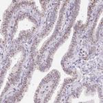 SP9 Antibody in Immunohistochemistry (Paraffin) (IHC (P))