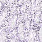 SP9 Antibody in Immunohistochemistry (Paraffin) (IHC (P))