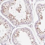 SP9 Antibody in Immunohistochemistry (Paraffin) (IHC (P))