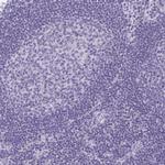 TAGLN3 Antibody in Immunohistochemistry (Paraffin) (IHC (P))