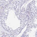 TAGLN3 Polyclonal Antibody