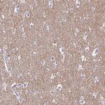 TAGLN3 Antibody in Immunohistochemistry (IHC)
