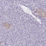 TAGLN3 Antibody in Immunohistochemistry (IHC)