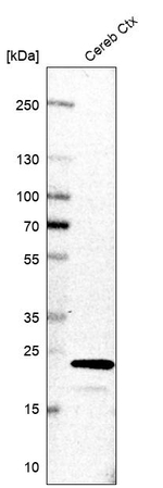 TAGLN3 Antibody in Western Blot (WB)