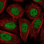PRR14L Polyclonal Antibody