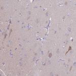 PRR14L Antibody in Immunohistochemistry (Paraffin) (IHC (P))