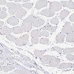 PRR14L Antibody in Immunohistochemistry (Paraffin) (IHC (P))