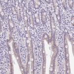 PRR14L Antibody in Immunohistochemistry (Paraffin) (IHC (P))