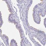 TCTEX1D4 Antibody in Immunohistochemistry (IHC)
