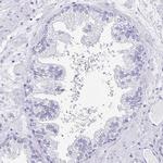 TCTEX1D4 Antibody in Immunohistochemistry (IHC)